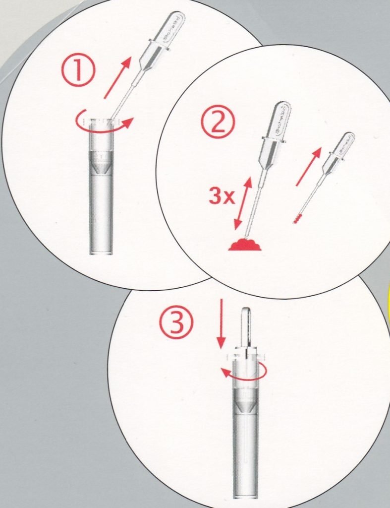 Enzymes Pancreatic Function Stool TestScheBo® Pancreas Elastase Rapid Test (1 unit